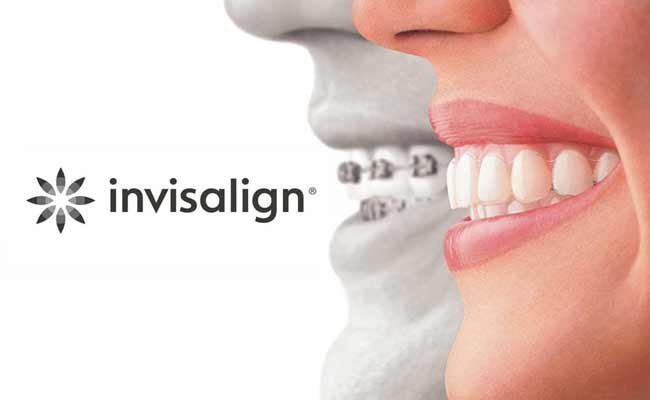 Invisalign Doctor Site Login 2022 Invisalign Doctor Site